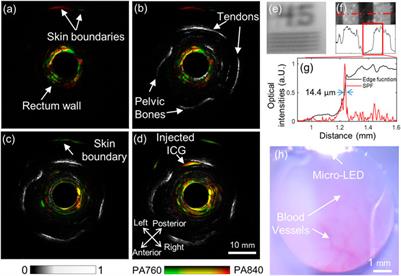 Spectroscopic photoacoustic/ultrasound/optical-microscopic multimodal intrarectal endoscopy for detection of centimeter-scale deep lesions